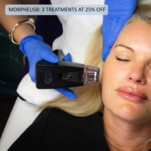 Load image into Gallery viewer, Morpheus8: Full Face &amp; Neck - 3 at 25% OFF
