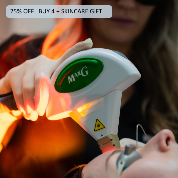 Pigmentation Laser - 25% OFF