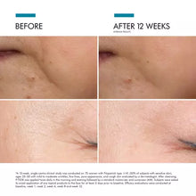 Load image into Gallery viewer, SkinCeuticals P-TIOX Anti-Wrinkle Peptide Serum
